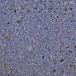 Microscopic view of tissue stained in shades of blue and purple, with scattered dark clusters and spots visible throughout the sample.