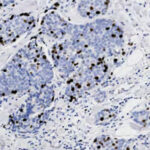 Microscopic image of tissue stained to show cell nuclei in blue and proliferating cells in brown, highlighting cellular activity and structure.