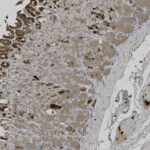 Microscopic image of tissue section showing cells stained brown, indicating areas of protein expression, with lighter unstained areas visible.