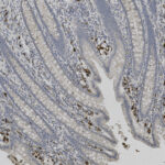 Microscopic view of stained tissue displaying elongated, layered cellular structures with dark brown and blue areas, likely indicating different cell types or staining reactions.