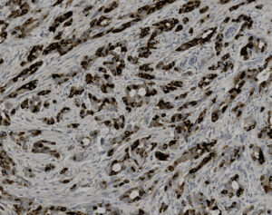 Tissue-Tek Genie<sup>&reg;</sup> anti-Mammaglobin