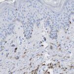 Microscopic image of a tissue section showing multiple layers of cells with dark-stained nuclei and scattered brown-stained immune cells in the lower region.