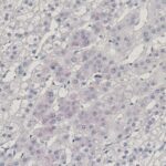 Microscope image shows liver tissue with scattered cells, visible nuclei, and some areas stained pink and purple, indicating variation in cell structure and composition.