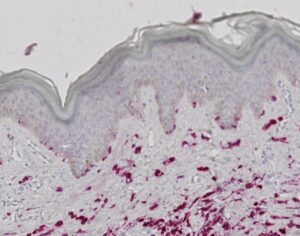 Tissue-Tek Genie<sup>&reg;</sup> anti-Melanoma Pan Antibody Cocktail [HMB45/EP43/T311]