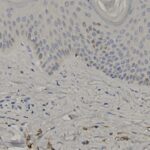 Microscopic image showing a section of epithelial tissue with densely packed nuclei in the upper layer and loosely arranged connective tissue below.