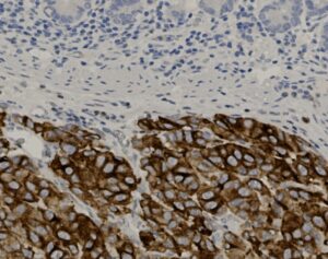 Tissue-Tek Genie<sup>&reg;</sup> anti-Melanosome