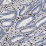Microscopic image of tissue showing elongated, oval-shaped glandular structures with blue and brown staining, surrounded by a fibrous matrix.