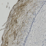 Microscopic image showing a cross-section of tissue with brown-stained elongated cells and blue nuclei, highlighting cellular structure and organization.