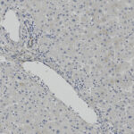 Microscopic view of liver tissue showing a bile duct and surrounding hepatocytes, with cell nuclei stained blue.