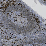 Microscopic image of tissue stained to show brown-stained immune cells clustered within a lighter background, indicating cell distribution within the sample.