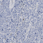 Microscopic image showing densely packed blue-stained cells with some lighter and darker areas, suggestive of a tissue sample stained for cellular analysis.