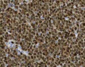 Tissue-Tek Genie<sup>&reg;</sup> anti-MUM-1