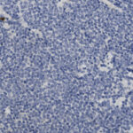 Microscopic view of densely packed blue-stained cells arranged in a uniform pattern, likely representing tissue or cell sample under high magnification.