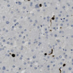 Microscopic view of stained brain tissue showing numerous small, round cell nuclei and scattered dark brown deposits.