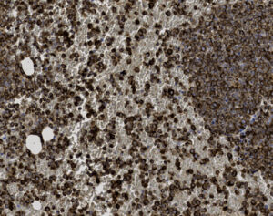 Tissue-Tek Genie<sup>&reg;</sup> anti-Myeloperoxidase (MPO)