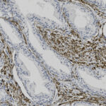 Microscopic image of tissue sections stained with brown, highlighting certain structures, and blue, marking cell nuclei.