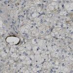 Microscopic view of tissue section showing numerous cells with dark blue stained nuclei and pale cytoplasm, some fibrous structures, and a small blood vessel on the left side.