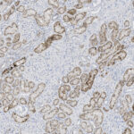 Microscopic view of tissue showing brown-stained areas interspersed with lighter regions, indicative of an immunohistochemistry analysis.