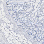 Microscopic image of human colon tissue showing glandular structures, adipose tissue, and nuclei stained blue.
