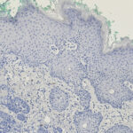 Microscopic image of human skin tissue section stained in blue and purple, showing layered epidermis and dermis, with green areas at the upper edge.