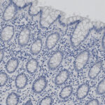 Microscopic image of human colon tissue shows glandular structures and cells stained in varying shades of blue.