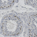 Microscopic image of several round cells, some with dark-stained nuclei, showing cell structures and variations in nuclear staining within tissue sections.