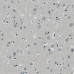 Microscopic image showing numerous cells with dark-stained nuclei scattered across a light background, characteristic of neural tissue.