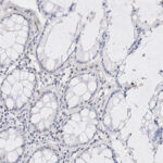 Microscopic image of tissue showing multiple oval and circular structures with surrounding cells, likely a cross-section of glandular or intestinal tissue.