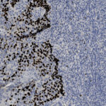 Microscopic image showing tissue stained with brown and blue dyes; brown-stained nuclei are grouped on the left, surrounded by mostly blue-stained cells on the right.