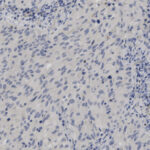 Microscopic image showing numerous oval-shaped, blue-stained cell nuclei scattered throughout a light background.