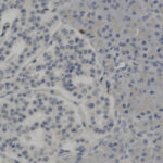 Microscopic image showing densely packed blue-stained cell nuclei within tissue, with some lighter areas indicating the surrounding extracellular matrix.