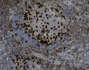 Tissue-Tek Genie<sup>&reg;</sup> anti-PD-1