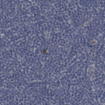 Microscopic view of densely packed blue-stained cells with a single small dark brown spot near the center.