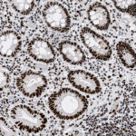 Microscopic view of tissue showing multiple oval structures lined with dark-stained cells and surrounded by lighter areas, likely representing glandular tissue stained for histological analysis.