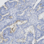 Microscopic image of tissue stained with blue and brown dyes, showing cellular structures and patterns for histological examination.