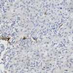 Microscopic image showing numerous small, round blue-stained cell nuclei within tissue; light brown staining is scattered throughout the sample.