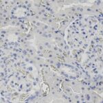 Microscopic view of human kidney tissue showing glomeruli and surrounding cells, with cell nuclei stained blue.