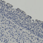 Microscopic image shows a layer of densely packed blue-stained cells with visible nuclei, likely representing a tissue sample section.