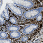 Microscopic image of tissue section stained to highlight specific cellular structures, showing oval-shaped glandular formations with blue and brown coloration.