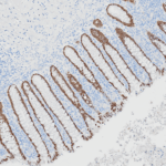 Microscopic image of intestinal tissue section stained to highlight specific proteins, showing brown-stained cells lining the villi and a blue counterstain in the background.