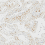 Microscopic image of tissue sections showing clusters of cells with brown-stained nuclei, indicating positive immunohistochemical staining; magnification 20x.
