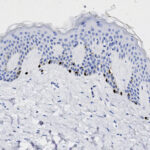 Microscopic image of a tissue section showing multiple layers of cells, with dark-stained nuclei concentrated in the upper layers, likely depicting skin or epithelial tissue.