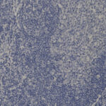 Microscopic image showing densely packed blue-stained cells, likely representing a section of tissue viewed under high magnification.