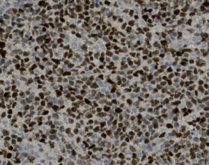 Tissue-Tek Genie<sup>&reg;</sup> anti-SOX11