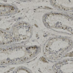 Microscopic image of tissue sections showing tubular structures with scattered darkly stained cell nuclei on a pale background.