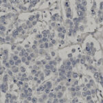 Microscopic image showing densely packed cells with visible nuclei stained in blue, typical of a tissue sample under high magnification.