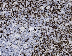 Tissue-Tek Genie<sup>&reg;</sup> anti-Terminal Deoxyribonucleotidyl Transferase