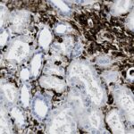 Microscopic view of tissue sample showing numerous oval-shaped cells with dark-stained borders and some densely packed darker regions.