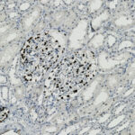 Microscopic image of tissue section showing two clusters of densely packed dark-stained cell nuclei surrounded by lighter staining, likely representing pancreatic islets within exocrine tissue.