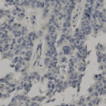 Microscopic image showing clusters of dark-stained cells with distinct nuclei on a light background, likely representing tissue or cellular sample under magnification.